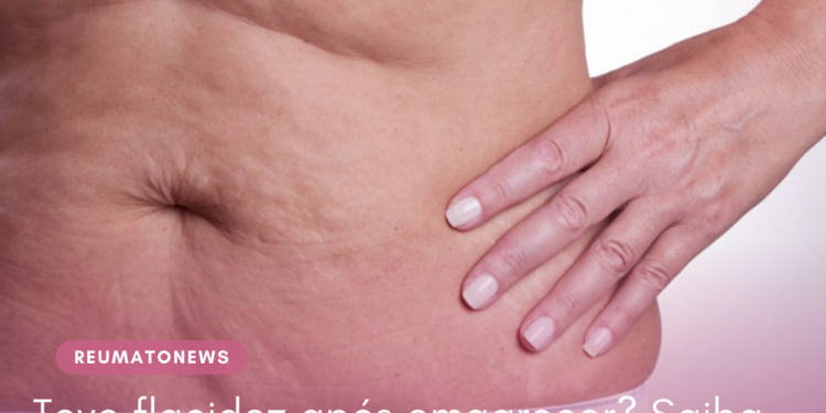 Teve flacidez após emagrecer? Saiba como eliminar o excesso de pele e recuperar a autoestima