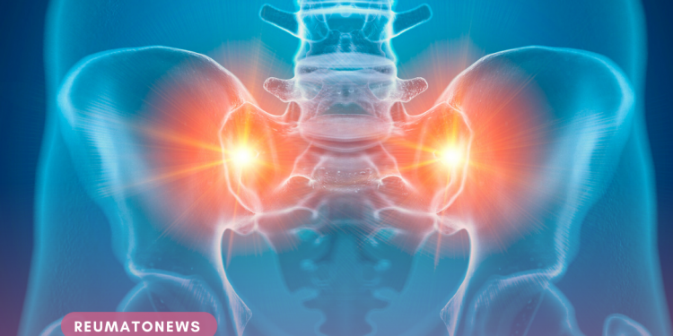 Artrose no quadril: o que é, causas, sintomas e tratamento