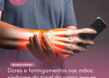 Dores e formigamentos nas mãos: síndrome do túnel do carpo requer atenção