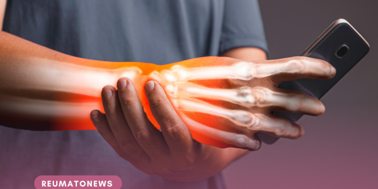 Dores e formigamentos nas mãos: síndrome do túnel do carpo requer atenção