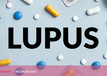 Lúpus e corticoide