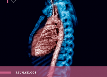 O que é  Arterite de Takayasu?