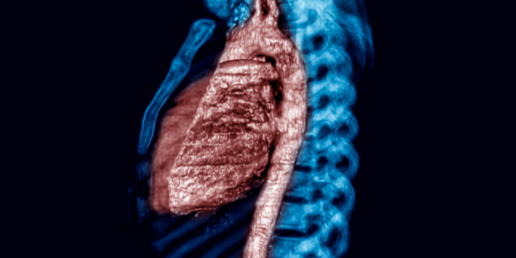O que é  Arterite de Takayasu?