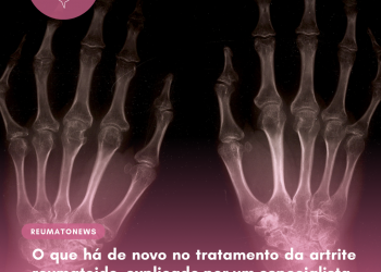 O que há de novo no tratamento da artrite reumatoide, explicado por um especialista