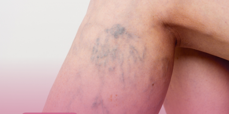 Prefeitura de Itamaraju recorre à justiça para não fornecer medicamento para mulher vítima de Covid-19