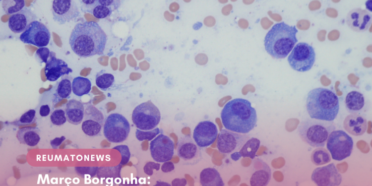 Março Borgonha: mês de conscientização do Mieloma Múltiplo