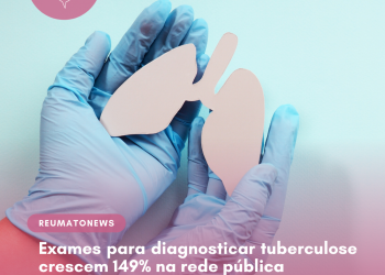 Exames para diagnosticar tuberculose crescem 149% na rede pública
