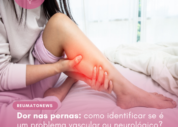 Dor nas pernas: como identificar se é um problema vascular ou neurológico?