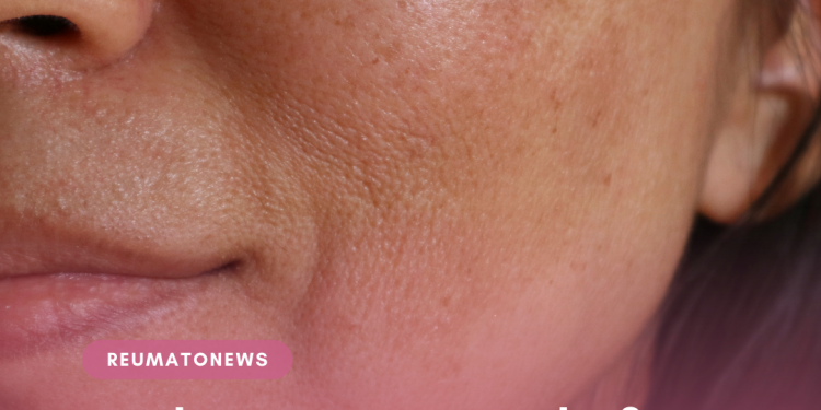 Sinusite e outono: como se cuidar nas épocas mais difíceis