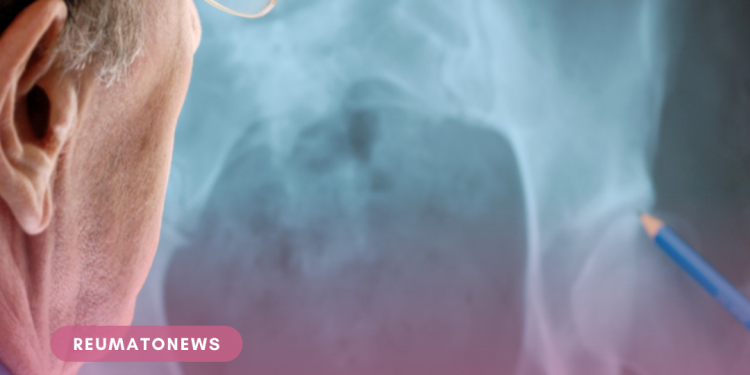 Já ouviu falar em doenças osteomusculares?