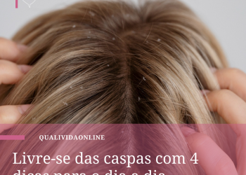 Livre-se das caspas com 4 dicas para o dia a dia