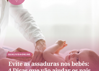 Evite as assaduras nos bebês: 4 Dicas que vão ajudar os pais