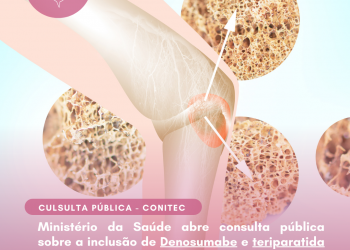 Ministério da Saúde abre consulta pública sobre a inclusão de Ofatumumabe para tratamento da esclerose múltipla recorrente