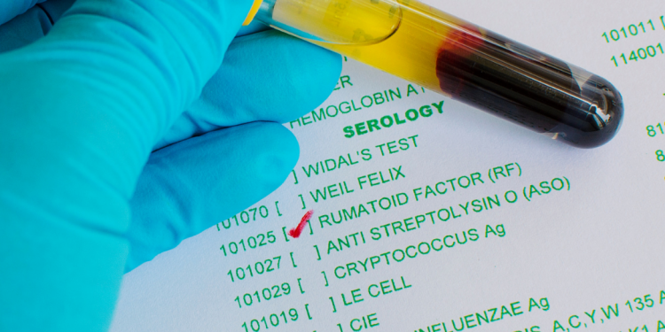 Fator reumatoide positivo… E agora?