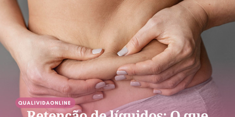 Retenção de líquidos: O que causa esse problema e como evitá-lo?