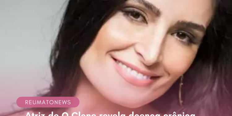 Atriz de O Clone revela doença crônica e vive dificuldades