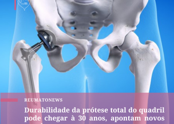 Durabilidade da prótese total do quadril pode chegar à 30 anos, apontam novos estudos