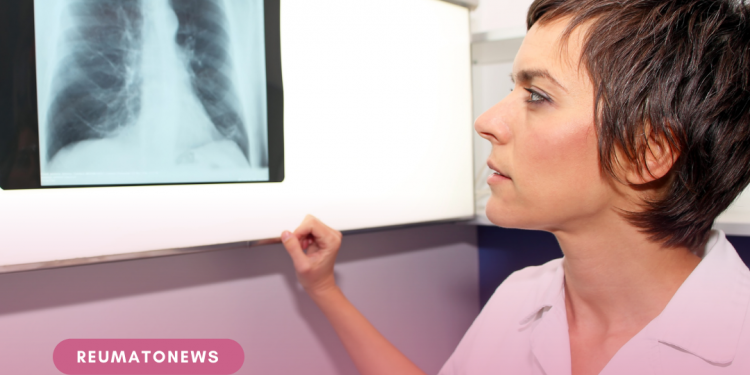 Crosstalks in PAH: a hipertensão arterial pulmonar e os novos horizontes desta patologia