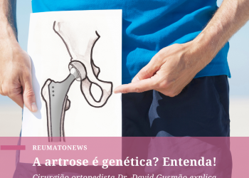 A artrose é genética? Entenda!