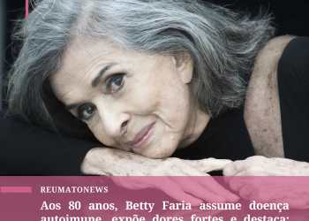 Aos 80 anos, Betty Faria assume doença autoimune, expõe dores fortes e destaca: “Luta diária”