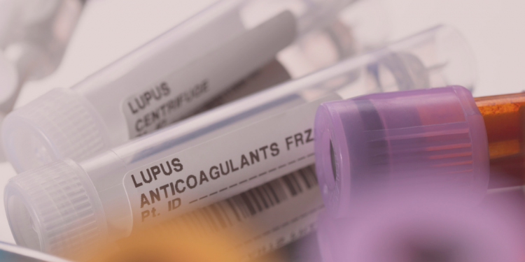 Médico Reumatologista explica sobre o Lúpus, doença autoimune que acomete muitos brasileiros