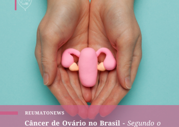 Câncer de Ovário no Brasil – Segundo o Inca, são estimados 6,650 novos casos no país anualmente