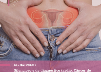 Silencioso e de diagnóstico tardio, Câncer de Ovário possui alta taxa de mortalidade, mas pode ser mapeado por fatores genéticos