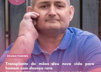 Transplante de mãos deu nova vida para homem com doença rara