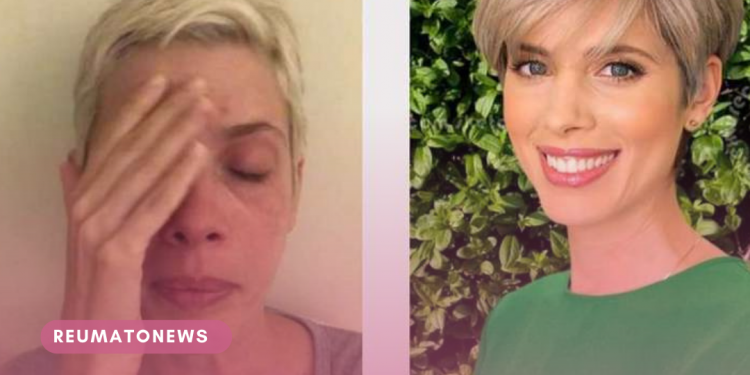 Dani Valente explica fibromialgia com foto de antes e depois da doença
