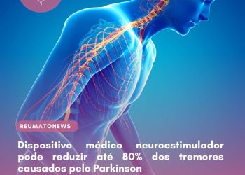 Dispositivo médico neuroestimulador pode reduzir até 80% dos tremores causados pelo Parkinson