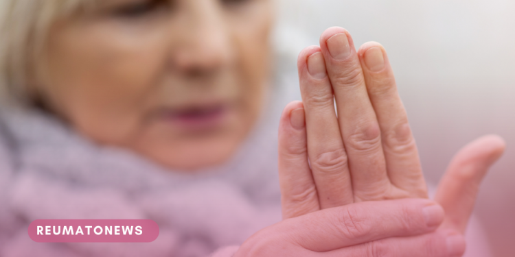 Qual a conexão entre a artrite reumatoide e a menopausa?