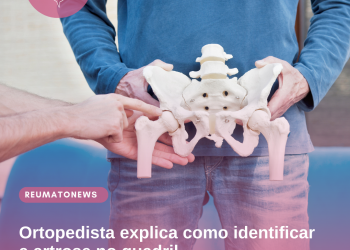 Ortopedista explica como identificar a artrose no quadril
