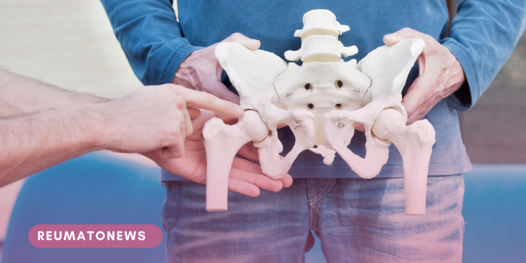 Ortopedista explica como identificar a artrose no quadril