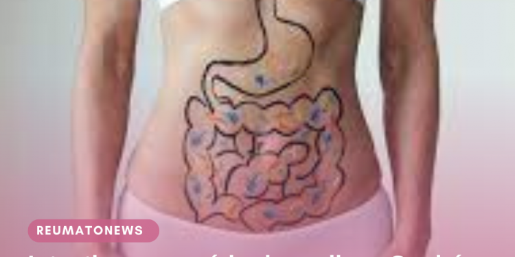 Intestino e a saúde da mulher: Qual é a relação?