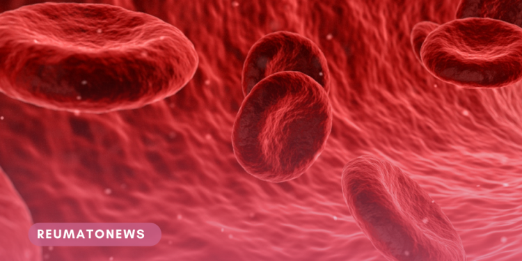 Estudo revela que ferro em excesso pode danificar órgãos e fala sobre ligação entre duas patologias