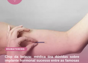 Chip da beleza: médica tira dúvidas sobre implante hormonal sucesso entre as famosas