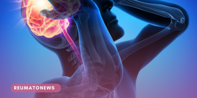 Confira mitos e verdades sobre o AVC