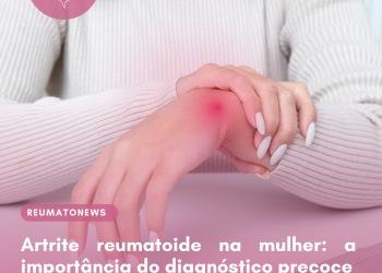 Artrite reumatoide na mulher: a importância do diagnóstico precoce