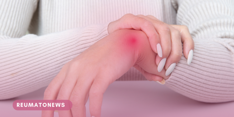 Artrite reumatoide na mulher: a importância do diagnóstico precoce