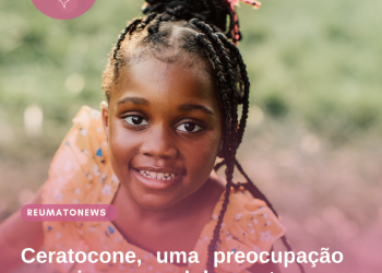 Ceratocone, uma preocupação em crianças e adolescentes