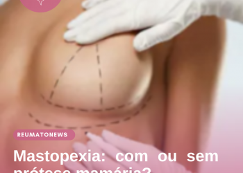 Mastopexia: com ou sem prótese mamária?