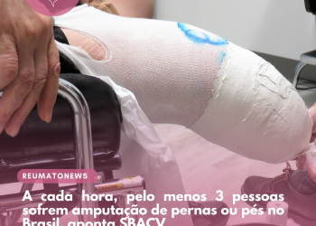 A cada hora, pelo menos 3 pessoas sofrem amputação de pernas ou pés no Brasil, aponta SBACV