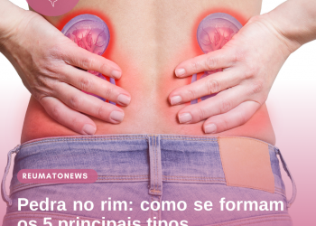Pedra no rim: como se formam os 5 principais tipos