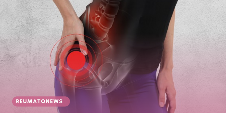 ARTROSE DE QUADRIL: Quando suspeitar? Como tratar?