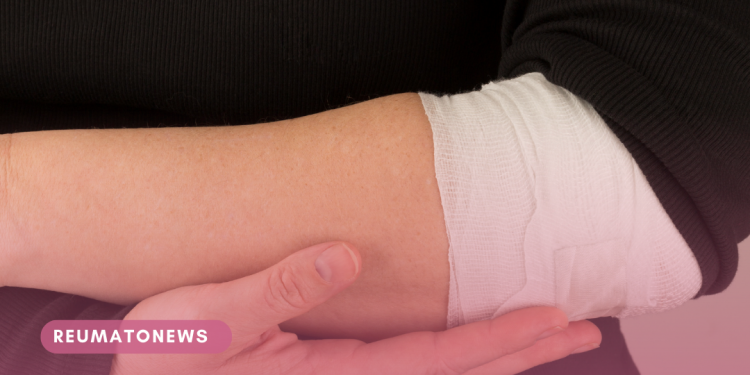 Conheça os tipos de tendinites, tratamentos e cuidados