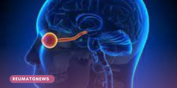 Neuromielite óptica: diagnóstico precoce é essencial e pode salvar vidas