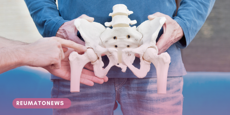 Estado tem dez dias para incluir paciente com artrose de quadril em lista de espera para realizar cirurgia