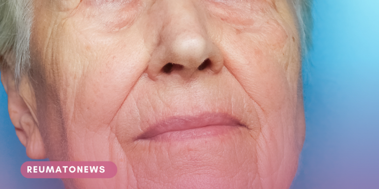 A catarata é responsável por 49% de perda de visão no Brasil