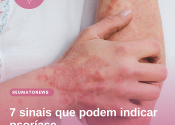 7 sinais que podem indicar psoríase