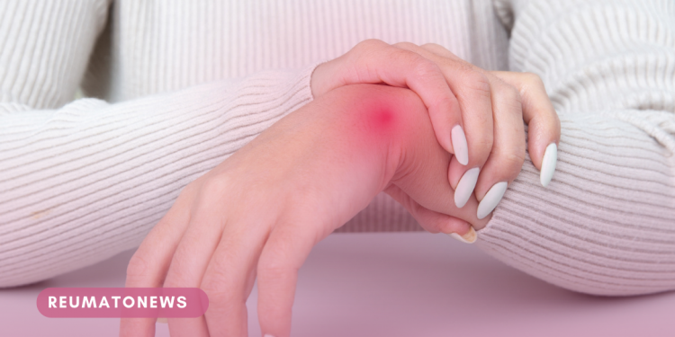 Manual Artrite Reumatoide